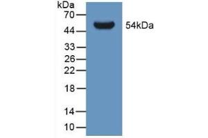 Detection of Recombinant GLTP, Human using Polyclonal Antibody to Glycolipid Transfer Protein (GLTP) (GLTP anticorps  (AA 2-209))