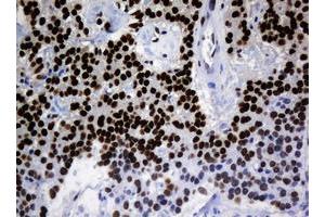 anti-Zinc Finger and SCAN Domain Containing 18 (ZSCAN18) antibody