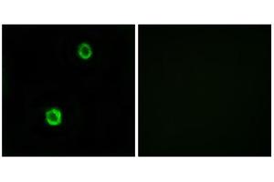 Immunofluorescence analysis of MCF-7 cells, using CST1 antibody. (CST1 anticorps  (Internal Region))