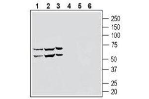 Western blot analysis of human  monocytic leukemia cell line lysate (lanes 1 and 4), human  natural killer cell line lysate (lanes 2 and 5) and human  promyelocytic leukemia cell line lysate (lanes 3 and 6) lysates: 1-3. (Sphingosine-1-Phosphate Receptor 5 (S1PR5) Peptide)