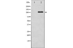 Western blot analysis of NMDAR1 phosphorylation expression in A549 whole cell lysates,The lane on the left is treated with the antigen-specific peptide. (GRIN1/NMDAR1 anticorps  (pSer890))