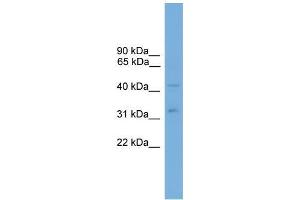 Human HT1080; WB Suggested Anti-ALS2CR4 Antibody Titration: 0. (TMEM237 anticorps  (Middle Region))