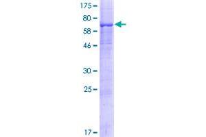 Image no. 1 for Phospholipase D Family, Member 5 (PLD5) (AA 1-445) protein (GST tag) (ABIN1315356)