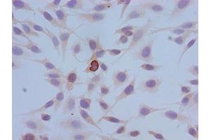 Immunocytochemistry analysis of Hela cells using ABIN7139614 at dilution of 1:100