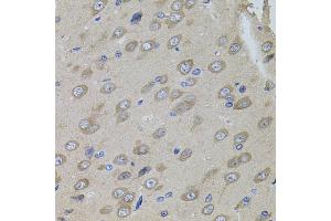 Immunohistochemistry of paraffin-embedded rat brain using SUMO3 antibody (ABIN5971585) (40x lens). (SUMO3 anticorps)