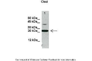 Lanes:   20 ug U937 cell lysate  Primary Antibody Dilution:   1:1000  Secondary Antibody:   Anti-rabbit HRP  Secondary Antibody Dilution:   1:2000  Gene Name:   Ctsd  Submitted by:   Ewelina Swiderek, Institute of Immunology and Experimental Therapy, Wroclaw, Poland (Cathepsin D anticorps  (C-Term))