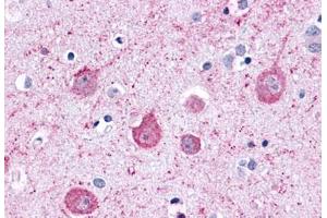 Anti-LPHN2 antibody  ABIN1049026 IHC staining of human brain, neurons and glia. (LPHN2 anticorps  (C-Term))