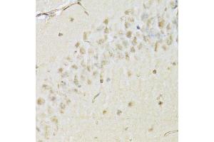 Immunohistochemistry of paraffin-embedded mouse brain using HDAC3 Antibody.