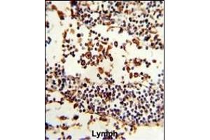 Formalin-fixed and paraffin-embedded human Lymph reacted with IGHA1 Antibody (C-term), which was peroxidase-conjugated to the secondary antibody, followed by DAB staining. (IGHA1 anticorps  (C-Term))