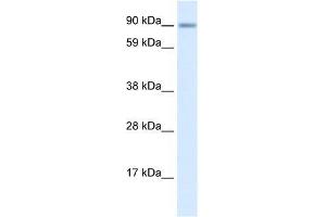 Human Lung; WB Suggested Anti-ZNF537 Antibody Titration: 0. (TSHZ3 anticorps  (Middle Region))