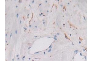 Detection of LGMN in Human Prostate Tissue using Polyclonal Antibody to Legumain (LGMN)