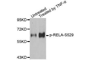 Western blot analysis of extracts from 293 cells, using Phospho-RELA-S529 antibody (ABIN2987626). (NF-kB p65 anticorps  (pSer529))