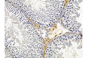 ABIN6266104 and ABIN6278813 at 1/100 staining rat testis tissue by IHC-P.