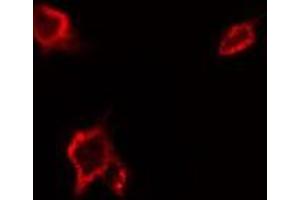 ABIN6277587 staining Hela by IF/ICC. (MERTK anticorps  (Internal Region))