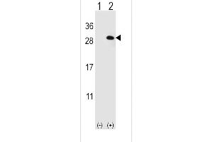 Western blot analysis of EIF4E2 using rabbit polyclonal EIF4E2 Antibody using 293 cell lysates (2 ug/lane) either nontransfected (Lane 1) or transiently transfected (Lane 2) with the EIF4E2 gene. (EIF4E2 anticorps)