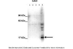 Lanes:   Lane1: 50 ug human placental tissue lysate Lane2: 40 ug human placental tissue lysate Lane3: 30 ug human placental tissue lysate Lane4: 20 ug human placental tissue lysate Lane5: 20 ug human myometrial tissue lysate  Primary Antibody Dilution:   1:500  Secondary Antibody:   Goat anti-rabbit HRP  Secondary Antibody Dilution:   1:10000  Gene Name:   Caveolin 2  Submitted by:   Hiten Mistry, Ania Czajka and Marta Hentschke Ribeiro, King's College London