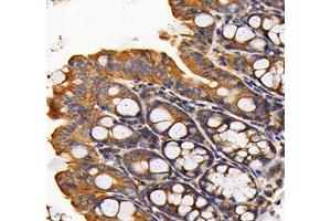 Immunohistochemistry of paraffin embedded mouse colon using RAB21 (ABIN7075341) at dilution of 1: 700 (400x lens)