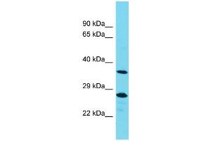Western Blotting (WB) image for anti-Protein Tyrosine Phosphatase, Non-Receptor Type 20A (PTPN20A) (Middle Region) antibody (ABIN2791465)
