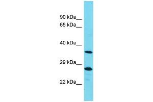 Western Blotting (WB) image for anti-Protein Tyrosine Phosphatase, Non-Receptor Type 20A (PTPN20A) (Middle Region) antibody (ABIN2791465) (PTPN20A anticorps  (Middle Region))