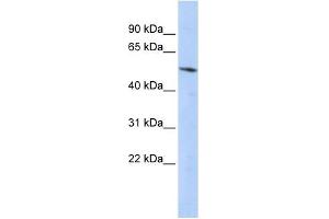 Western Blot showing BCL6B antibody used at a concentration of 1-2 ug/ml to detect its target protein. (BCL6B anticorps  (Middle Region))