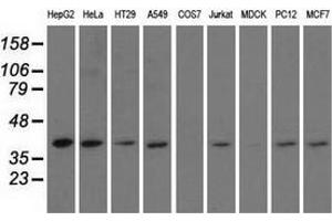 Western blot analysis of extracts (35 µg) from 9 different cell lines by using anti-HIBCH monoclonal antibody. (HIBCH anticorps)