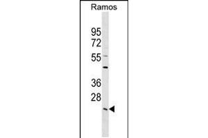 Western blot analysis in Ramos cell line lysates (35ug/lane). (LYPLA2 anticorps  (C-Term))