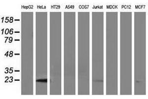 Image no. 2 for anti-Lin-7 Homolog B (LIN7B) antibody (ABIN1499156) (LIN7B anticorps)