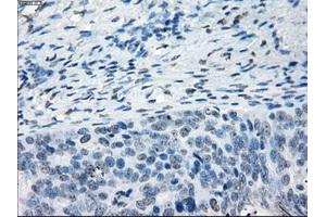 Immunohistochemical staining of paraffin-embedded colon tissue using anti-NAT8mouse monoclonal antibody. (NAT8 anticorps)