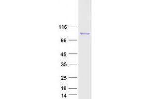 Validation with Western Blot