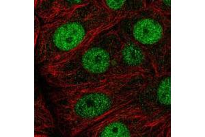 Immunofluorescent staining of MCF7 cells with MCM7 polyclonal antibody  (Green) shows positivity in nucleus but excluded from the nucleoli. (MCM7 anticorps)