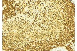 ABIN6269173 at 1/100 staining Mouse spleen tissue by IHC-P.