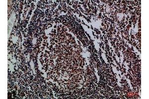 Immunohistochemical analysis of paraffin-embedded Human-tonsil, antibody was diluted at 1:100 (IL17D anticorps  (AA 141-190))