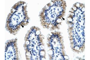 Annexin A4 antibody was used for immunohistochemistry at a concentration of 4-8 ug/ml to stain Epithelial cells of intestinal villus (lndicated with Arrows) in Human Intestine.