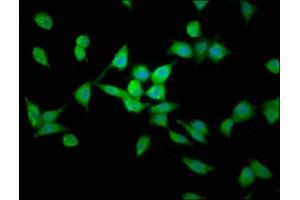 Immunofluorescence staining of SH-SY5Y cells with ABIN7158792 at 1:200, counter-stained with DAPI.