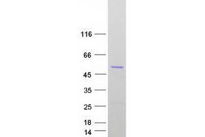 Validation with Western Blot