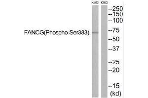 Western blot analysis of extracts from K562 cells, using FANCG (Phospho-Ser383) antibody. (FANCG anticorps  (pSer383))