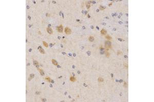Immunohistochemistry of paraffin-embedded mouse brain using PDPK1 Antibody (ABIN5970826) at dilution of 1/200 (40x lens).