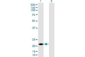 Western Blot analysis of CSH2 expression in transfected 293T cell line by CSH2 MaxPab polyclonal antibody. (CSH1 anticorps  (AA 1-217))