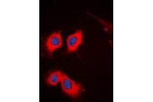 Immunofluorescent analysis of PKC theta staining in HeLa cells. (PKC theta anticorps  (C-Term))