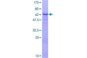 Image no. 1 for serum/glucocorticoid Regulated Kinase 2 (SGK2) (AA 1-367) protein (GST tag) (ABIN1319823)