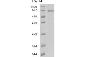 (Tris-Glycine gel) Discontinuous SDS-PAGE (reduced) with 5 % enrichment gel and 15 % separation gel.