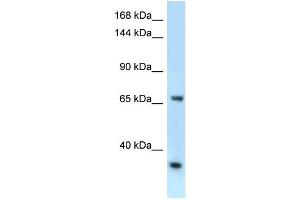 WB Suggested Anti-Rbm15b Antibody   Titration: 1. (RBM15B anticorps  (C-Term))