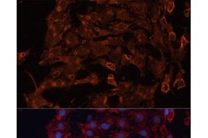 Immunofluorescence analysis of C6 cells using ABCB11 Polyclonal Antibody at dilution of 1:100.