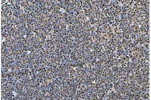 IHC analysis of SNRPN using anti-SNRPN antibody (ABIN3043934). (SNRPN anticorps  (N-Term))