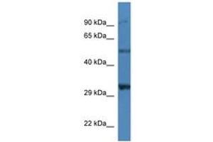 Image no. 1 for anti-Sarcoglycan, delta (35kDa Dystrophin-Associated Glycoprotein) (SGCD) (AA 37-86) antibody (ABIN6746239) (SGCD anticorps  (AA 37-86))