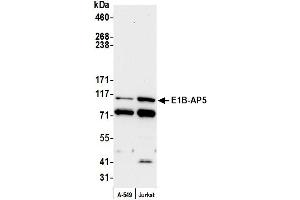 Western Blotting (WB) image for anti-Heterogeneous Nuclear Ribonucleoprotein U-Like 1 (HNRNPUL1) (C-Term) antibody (ABIN7453846)