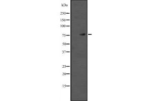 Western blot analysis of TAB2 expression in HEK293 cells ,The lane on the left is treated with the antigen-specific peptide. (TAB2 anticorps  (Internal Region))