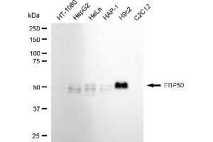Western blotting analysis using EBP50 antibody (ABIN7800401).