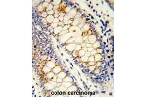 Immunohistochemistry (IHC) image for anti-serine/arginine-Rich Splicing Factor 1 (SRSF1) antibody (ABIN3002838)