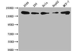 Western Blot Positive WB detected in: A549 whole cell lysate, 293 whole cell lysate, Hela whole cell lysate, HepG2 whole cell lysate, MCF-7 whole cell lysate All lanes: PLXNB2 antibody at 1:1000 Secondary Goat polyclonal to rabbit IgG at 1/50000 dilution Predicted band size: 206 kDa Observed band size: 206 kDa (Plexin B2 anticorps  (AA 1458-1673))